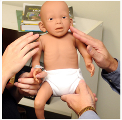 Picture of RealCare™ Fetal Alcohol Syndrome Baby