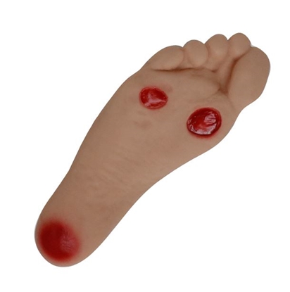 Picture of Diabetic Foot Ulcer Model