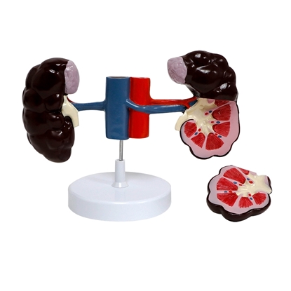 Picture of Cow Kidney Model