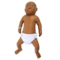 Picture of Down Syndrome Baby