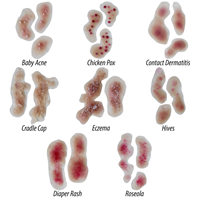 Infant Skin Conditions Light Colors