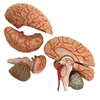 Picture of Brain and Cerebral Arteries Model