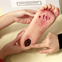 Picture of Geriatric Foot Care Model