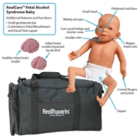 Photo de Fetal Alcohol Syndrome Baby