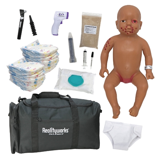 Picture of Common Childhood Illnesses Baby